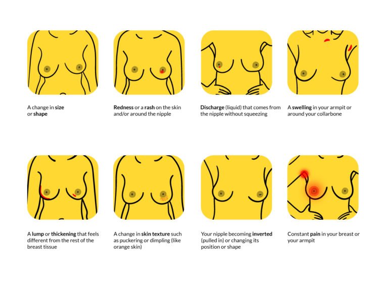 Know your breasts!